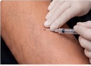 Close-up of a cosmetic procedure demonstration